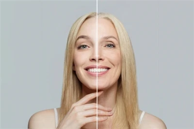 Is NMN superior to collagen?
